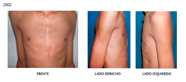 faq centro clinico orthopectus2